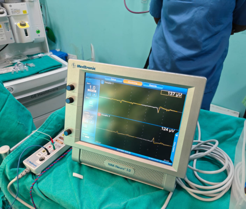 Total Thyroidectomy